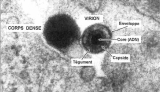 Image d'une particule de CMV en microscopie électronique