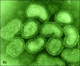 Virus grippaux en microscopie électronique