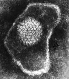 Particule d'Herpes simplex virus en microscopie électronique.