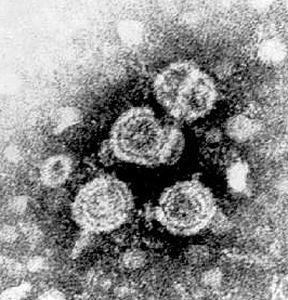 Particule de VHB en microscopie électronique