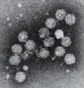 Particules de VHC vues en microscopie électronique