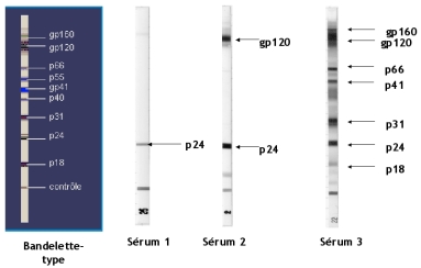 Evolution du profil d'anticorps au cours d'une séroconversion pour le VIH-1.