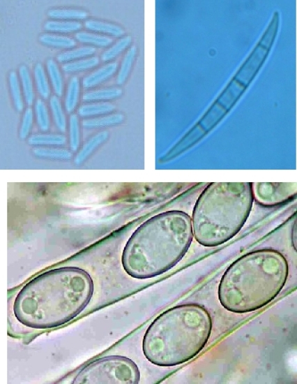 Hyalospore: incolore ou hyaline