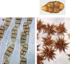 Mélanospore ou Phaeospore: pigmentée