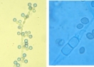 Candida (à gauche) - Rhizopus (à droite)