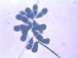 Didymospores