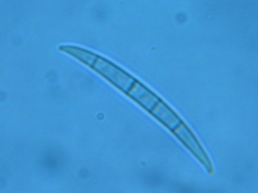 Phragmospores