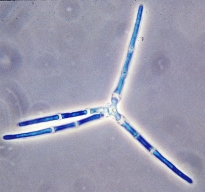 Staurospores
