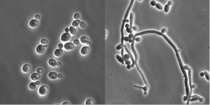 Image au microscope du champignon responsable d'une mycose vaginale